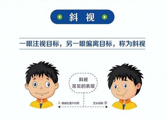 贵港全城仅此一家！斜视术后还能做“视觉训练”的医院在这里